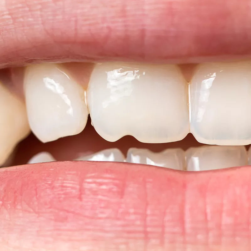 Enamel Care