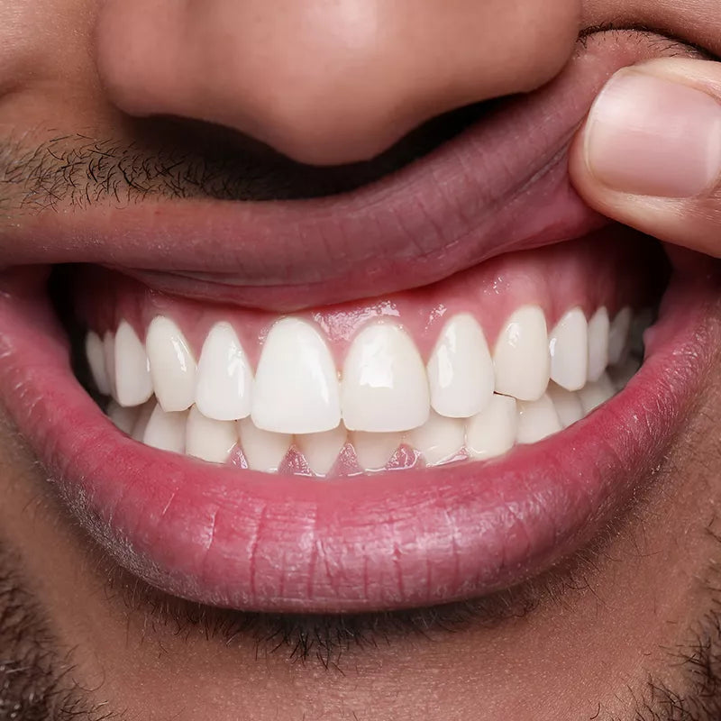 Gum Health